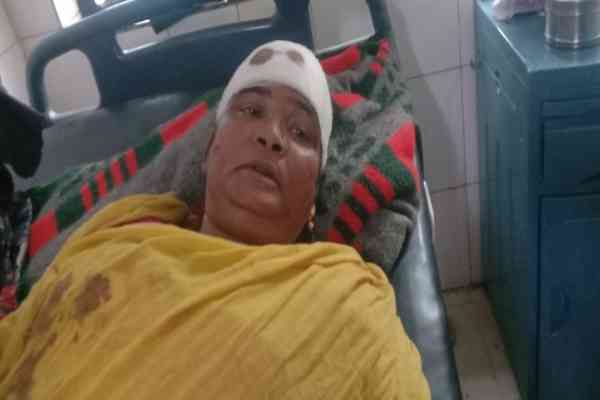 एसएनएमएमसीएच में इलाजरत घायल महिला